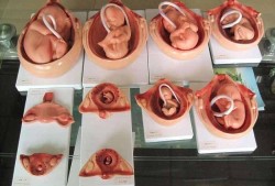 胎儿声音（胎儿声音刺激试验是什么检查）