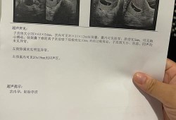 孕5周孕囊的大小是多少呢,孕期5周的孕囊大小是多少