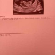 孕期检查nt（孕期检查nt检查什么的）
