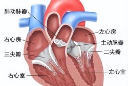 新生儿二尖三尖瓣大量返流要手术吗,胎儿三尖瓣重度返流可以生吗
