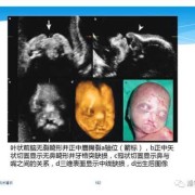 胎儿什么时候长眼睛（胎儿什么时候长眼睛鼻子）