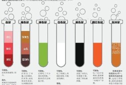 孕期尿颜色（孕中期发现尿的颜色有变化了，这是怎么回事啊）