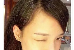 孕期白发（孕期白发增多是什么原因）