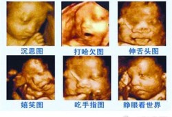 如何看胎儿彩超（如何看胎儿彩超图）