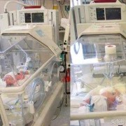 32周早产怎么办,32周胎儿早产可存活吗正常吗