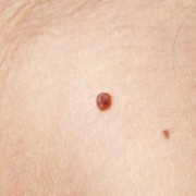 怀孕期间乳头有脏东西（怀孕期间乳头有脏东西怎么回事）