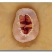 孕6月胎儿姿势图片（怀孕六个月胎儿趴着是什么原因）