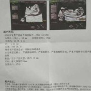 胎儿nt值正常范围（产检nt值多少正常）