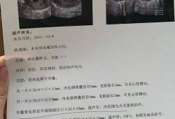 怀孕中期胎儿有时候不动正常吗,b超胎儿不动怎么刺激
