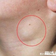 孕期腋下淋巴（孕期腋下淋巴结肿大正常吗）