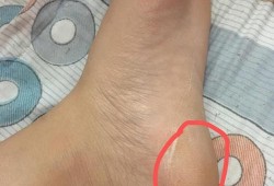 孕期脚板痛（孕期脚板痛正常吗）