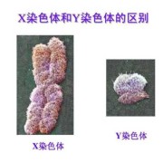 胎儿偏小 染色体（什么是染色体畸变CNV）