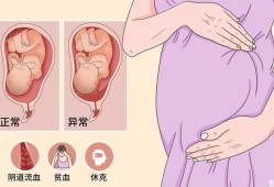 孕妇血压低对胎儿发育有影响吗,胎盘低会影响胎儿发育吗知乎