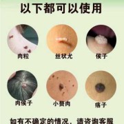 治疗孕期疣（孕七个月胸上长类似扁平疣的东西怎么办）