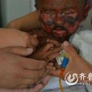 胎儿坏死有什么症状（胎儿坏死有什么症状吗）