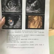 nt和st的区别,孕期英语怎么写