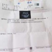 胎儿偏小十天（胎儿偏小十天怎么办,要紧吗）