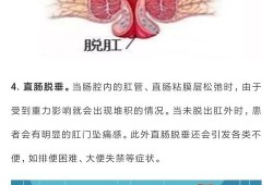 孕期肛门下坠（月经过后肛门下坠是什么原因）