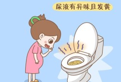 孕期尿黄是怎么回事,整个孕期尿黄怎么回事