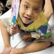 B超可以检查出胎儿脑瘫吗,胎儿脑瘫能检查出来吗唐氏筛查多少钱