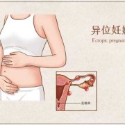 怀孕期间肚子疼正常吗（怀孕期间肚子疼正常吗做什么检查）