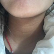孕妇可以漂胡子吗,孕期长胡子正常吗