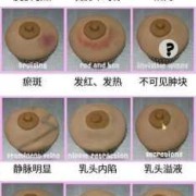 怀孕后乳头痒怎么办,孕期乳晕痒怎么回事儿