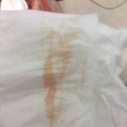 孕期早上出血（孕期早上出血是什么原因）