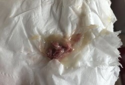 孕妇鼻屎多怎么回事,孕期鼻屎多怎么回事,而且还有血丝