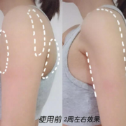 孕期胳膊粗（孕期胳膊粗怎么减肥）