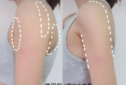 孕期胳膊粗（孕期胳膊粗怎么减肥）