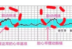 胎心监护多少分正常,胎儿心电图怎么做图片