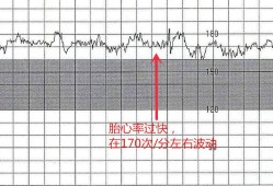 七个月胎儿胎心率（三个月胎儿心率170到180正常吗）