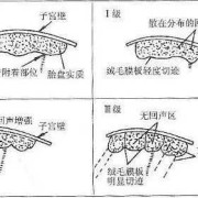 生孩子的时候胎盘一般达到几级,胎儿几周长胎盘开始分泌孕激素
