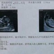 nt和st的区别,孕期英语怎么写