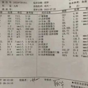 看b超单怎么算胎儿体重（37周双顶径95股骨长71能算出胎儿多重吗）