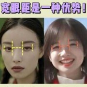 胎儿眼距宽的标准值（多宽算宽眼距）