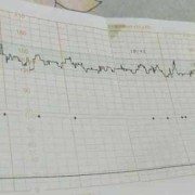 快走心率150正常吗,胎儿心跳150左右是男孩还是女孩
