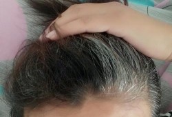 怀孕头发变白怎么回事我该做的事情是什么呀,孕期长白发是什么原因