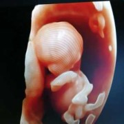 怀孕12周胎儿（怀孕12周了孩子小怎么回事）