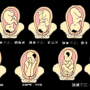 枕后位缩写,胎儿枕后位是什么意思