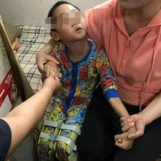 胎儿脑瘫能查出来吗（怀孕期间胎儿脑瘫能查出来吗）