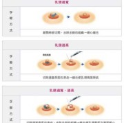 孕期乳头开裂怎么办（乳头根部裂开怎么办）