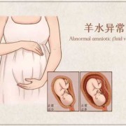 孕期羊水多怎么办（孕晚期羊水多怎么办）