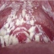 孕期流黄绿色分泌物（孕期流黄绿色分泌物对胎儿有影响吗）