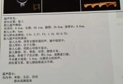 孕十六周胎儿发育情况（孕16周羊水4.2是正常的吗?医生提醒要多喝水，会产生什么危害呢）
