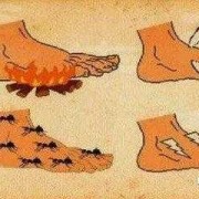 孕期脚麻手麻（孕期脚麻手麻是什么原因）
