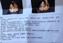 胎儿胆囊下（我怀孕36周+4天了检查的胎儿胆囊大小约28.7*8.2mm正常吗）