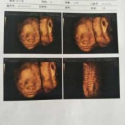 宝宝三维图怎么用ai生成,三维胎儿长相看男女准吗