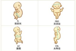 胎儿双顶径大头就大吗，双顶径大小和什么有关,胎儿大头是儿子还是女儿